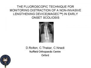 THE FLUOROSCOPIC TECHNIQUE FOR MONITORING DISTRACTION OF A