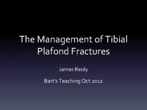 The Management of Tibial Plafond Fractures James Reidy