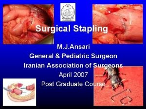 Surgical Stapling M J Ansari General Pediatric Surgeon