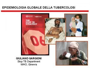 EPIDEMIOLOGIA GLOBALE DELLA TUBERCOLOSI GIULIANO GARGIONI Stop TB