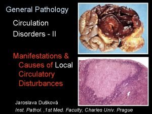 Haemorrhagia per rhexin