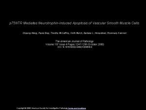 p 75 NTR Mediates NeurotrophinInduced Apoptosis of Vascular