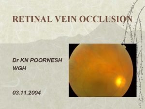 RETINAL VEIN OCCLUSION Dr KN POORNESH WGH 03