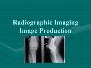 Radiographic Imaging Image Production Terms Related to Image