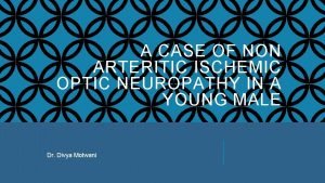 A CASE OF NON ARTERITIC ISCHEMIC OPTIC NEUROPATHY