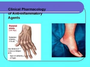 Clinical Pharmacology of Antiinflammatory Agents RHEUMATIC DISEASES Rheumatic