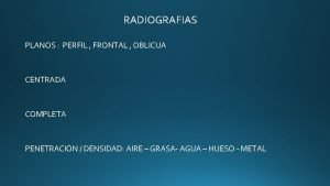 Radiografia de cadera normal