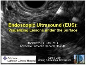 Endoscopic Ultrasound EUS Visualizing Lesions under the Surface