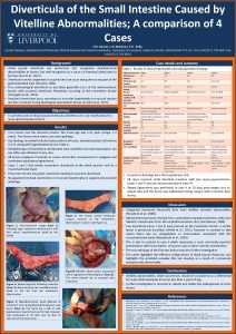 Diverticula of the Small Intestine Caused by Vitelline