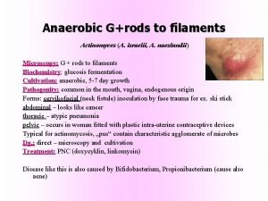 Anaerobic Grods to filaments Actinomyces A israelii A