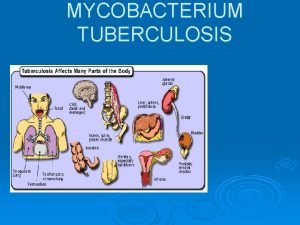 Miliary pulmonary tuberculosis