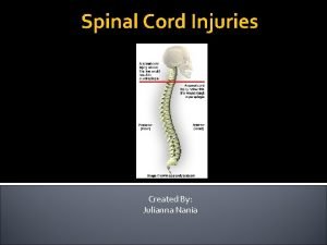 Spinal Cord Injuries Created By Julianna Nania What