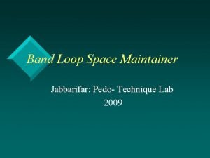Band and loop space maintainer