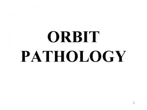 Orbit irigation