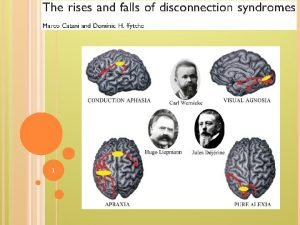 1 Disconnection Syndromes DS Higher function deficits resulted