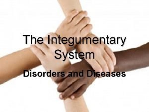 The Integumentary System Disorders and Diseases Acne Vulgaris