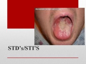 STDsSTIS STDsexually transmitted disease Also called an STI