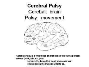 Cerebral palsy mild