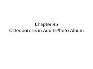 Chapter 45 Osteoporosis in Adults Photo Album FIGURE
