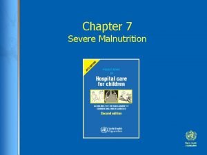 Severe acute malnutrition case presentation