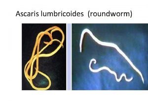 Ascaris lumbricoides roundworm Introduction Most common helminthic human