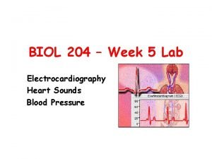 1500 method ecg