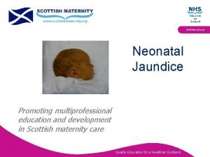 Multidisciplinary Neonatal Jaundice Promoting multiprofessional education and development