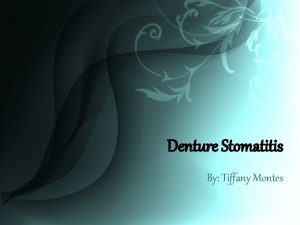Denture Stomatitis By Tiffany Montes What is Denture