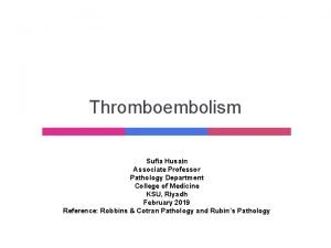 Thromboembolism