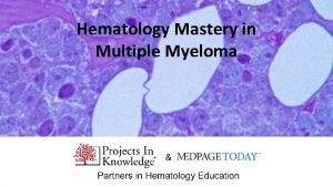 Hematology Mastery in Multiple Myeloma Part I Smoldering