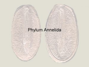 Annelid body plan