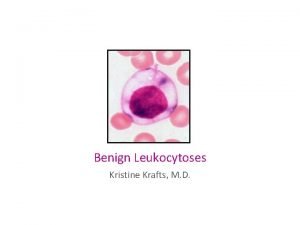 Benign Leukocytoses Kristine Krafts M D Benign Leukocytoses