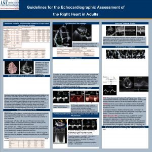 Guidelines for the Echocardiographic Assessment of the Right