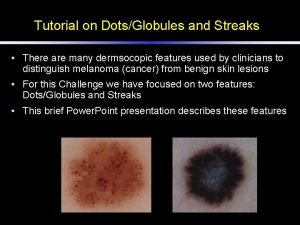 Tutorial on DotsGlobules and Streaks There are many