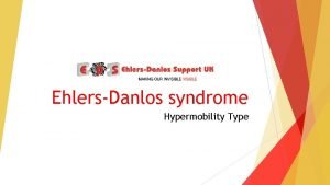 EhlersDanlos syndrome Hypermobility Type What is EhlersDanlos syndrome