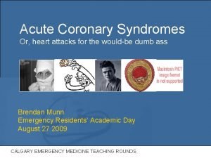 Acute Coronary Syndromes Or heart attacks for the