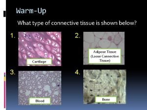 Dense regular connective tissue tendon