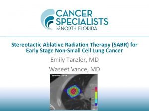 Stereotactic Ablative Radiation Therapy SABR for Early Stage