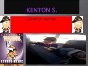 KENTON S Klinefelter syndrome It only comes in
