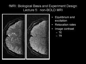 f MRI Biological Basis and Experiment Design Lecture