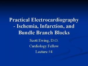 Practical Electrocardiography Ischemia Infarction and Bundle Branch Blocks