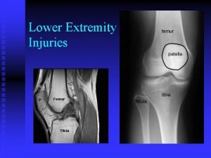 Lower Extremity Injuries All You Need to Know