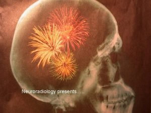 Neuroradiology presents Cerebrovascular Disease David M Pelz MD