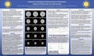 Computed Tomography CT Measurements of Attenuation Influence of