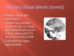 Pituitary fossa lateral coned l l l Position