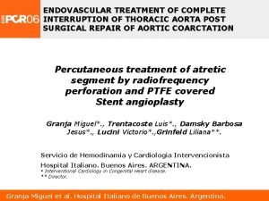 ENDOVASCULAR TREATMENT OF COMPLETE INTERRUPTION OF THORACIC AORTA