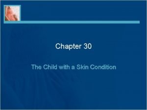 Chapter 30 the child with a skin condition