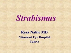 Strabismus Reza Nabie MD Nikookari Eye Hospital Tabriz