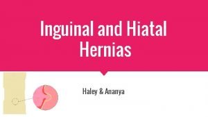 Inguinal and Hiatal Hernias Haley Ananya What is