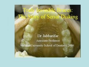 Teeth disking